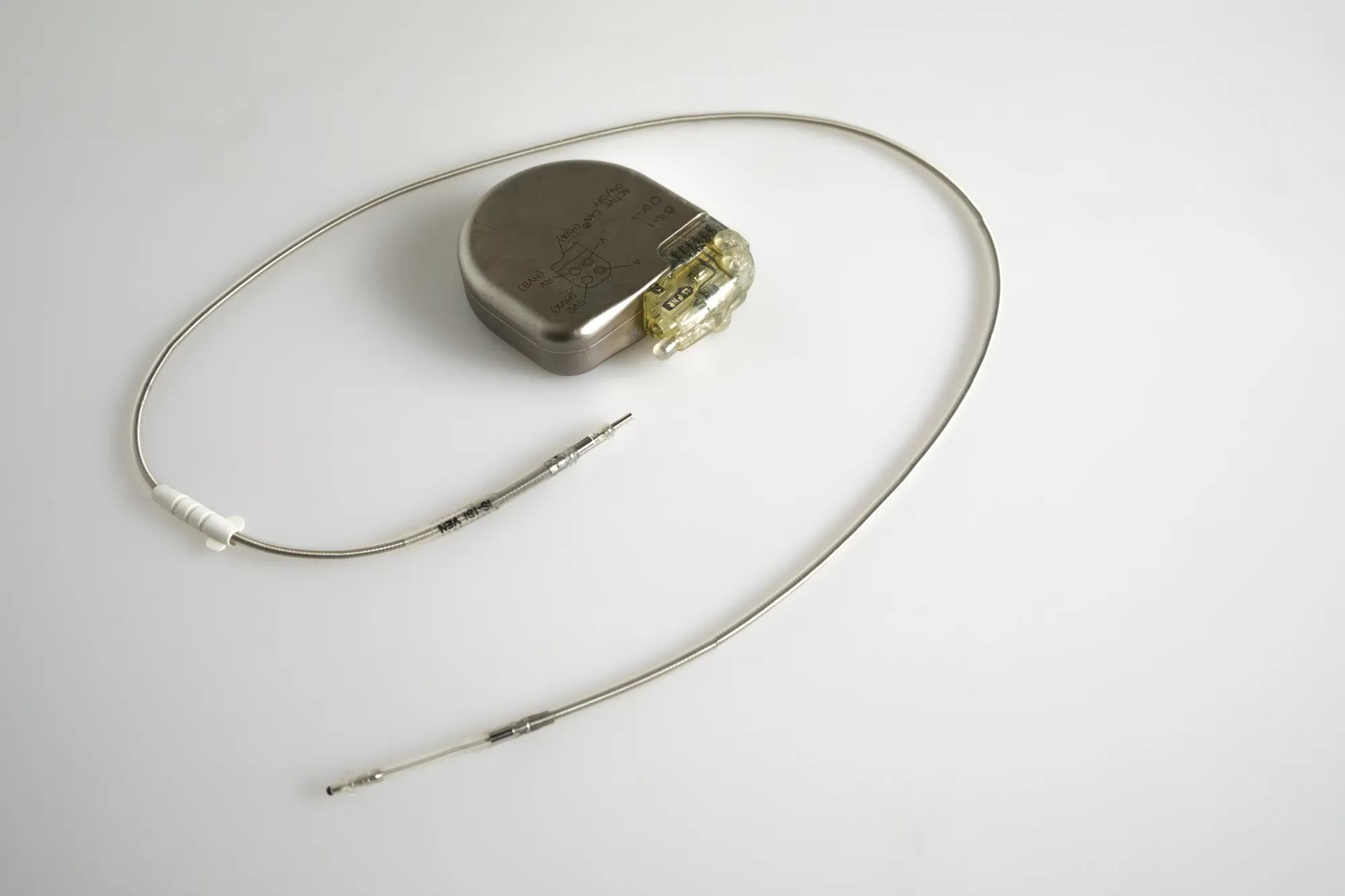 An Implantable Cardioverter Defibrillator or ICD pacemaker with leads and modem for telemonitoring at home. The device sends data to the hospital on a regular basis.