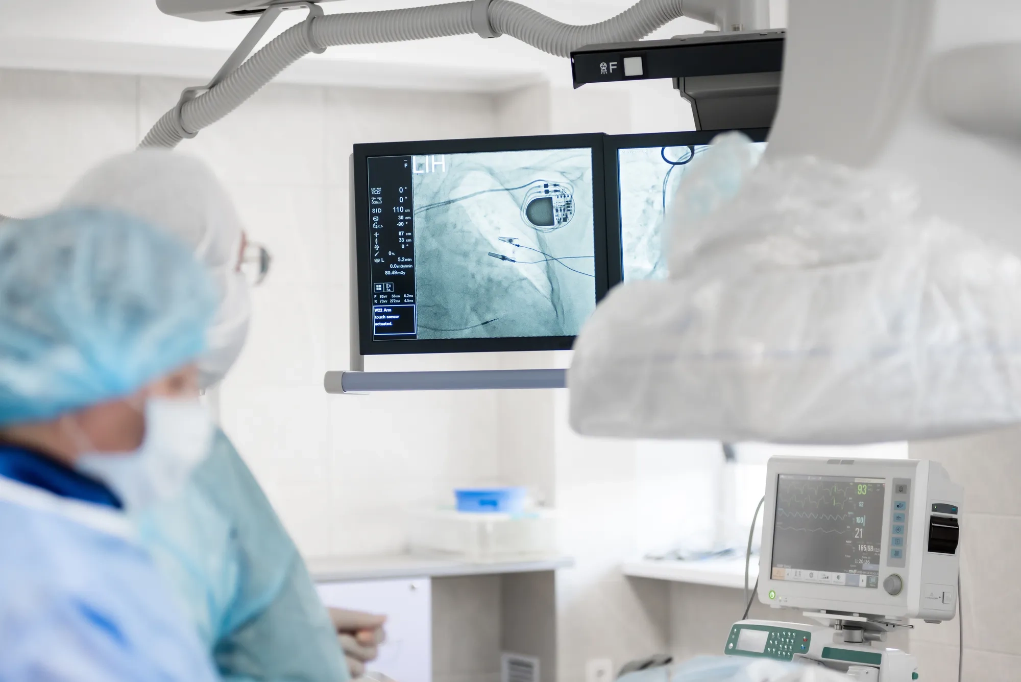 a cardiac surgeon in the operating room, observes on x-ray monitors, a pacemaker installed in a patient. cardiovascular surgery. 